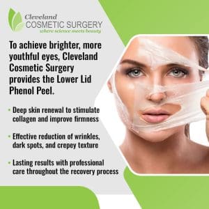 A woman gently peels a facial mask from her face, with text describing how Cleveland Cosmetic Surgery's Lower Lid Phenol Peel offers deep skin renewal and wrinkle reduction for youthful eyes.