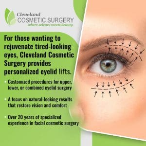A close-up of a human eye with arrows indicating areas for an eyelid lift procedure, accompanied by text detailing Cleveland Cosmetic Surgery's personalized eyelid lifts and their benefits.