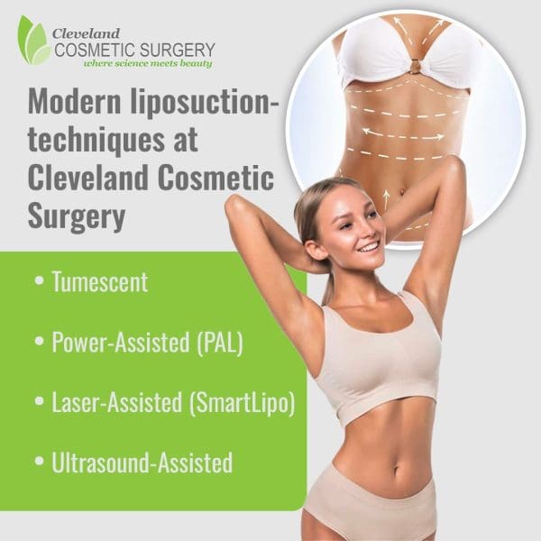 An advertisement for modern liposuction techniques at Cleveland Cosmetic Surgery, featuring a smiling woman with a fit physique.