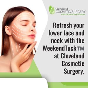 Woman touching jawline with directional arrows showing lower face and neck rejuvenation using WeekendTuck at Cleveland Cosmetic Surgery.