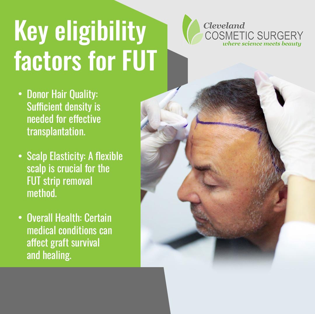 Hair transplant specialist assessing scalp for FUT eligibility with marked hairline and donor area